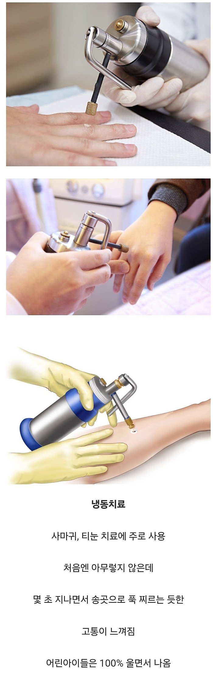 7861193448_486616_d98647c8e65e7e70ac37c03c85b30ccb.jpg 피부과에서 느낄수 있는 최악의 고통.jpg